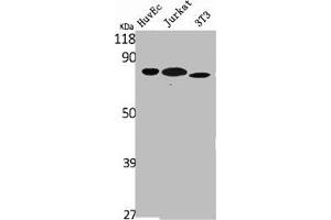 Western Blot analysis of HuvEc Jurkat NIH-3T3 cells using Ezrin Polyclonal Antibody (Ezrin antibody  (C-Term))