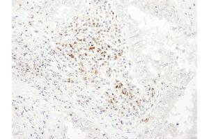 Immunohistochemistry (IHC) image for anti-CD3 epsilon (CD3E) (AA 157-207) antibody (ABIN7453426) (CD3 epsilon antibody  (AA 157-207))