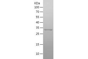 Western Blotting (WB) image for Translocase of Outer Mitochondrial Membrane 40 Homolog (TOMM40) (AA 1-73) protein (His-IF2DI Tag) (ABIN7125473) (TOMM40 Protein (AA 1-73) (His-IF2DI Tag))