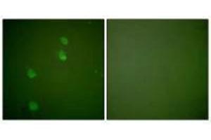 Immunofluorescence analysis of NIH/3T3 cells, using Cullin 2 antibody. (Cullin 2 antibody)