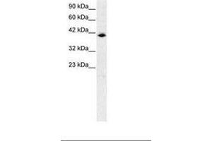 Image no. 1 for anti-Interferon Regulatory Factor 9 (IRF9) (AA 41-90) antibody (ABIN6735770) (IRF9 antibody  (AA 41-90))