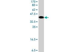 Western Blot detection against Immunogen (37. (URI1 antibody  (AA 371-475))