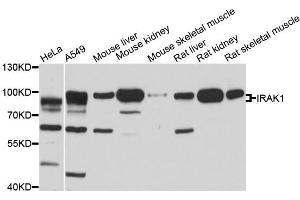 Western blot analysis of extracts of various cell lines, using IRAK1 antibody. (IRAK1 antibody)