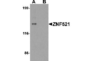 Western blot analysis of ZNF521 in HeLa cell lysate with ZNF521 antibody at 1 µg/mL in (A) the absence and (B) the presence of blocking peptide. (ZNF521 antibody  (N-Term))
