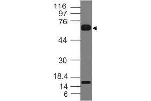 Image no. 1 for anti-Interleukin 1 Receptor-Like 2 (IL1RL2) (AA 1-203) antibody (ABIN5027304) (IL1RL2 antibody  (AA 1-203))