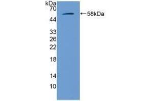 Detection of Recombinant GbA, Mouse using Polyclonal Antibody to Glucocerebrosidase (GBA) (GBA antibody  (AA 255-509))