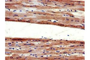 Immunohistochemistry of paraffin-embedded human heart tissue using ABIN7173980 at dilution of 1:100 (Angiotensin II Type-1 Receptor antibody  (AA 306-356))