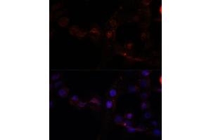 Immunofluorescence analysis of  cells using C antibody (ABIN7266034) at dilution of 1:100. (Calpain 7 antibody  (AA 20-220))