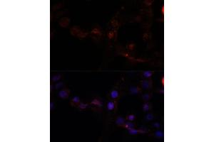 Immunofluorescence analysis of  cells using C antibody (ABIN7266034) at dilution of 1:100.