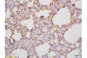 Formalin-fixed and paraffin embedded mouse lung labeled with Rabbit Anti Rabbit Anti-IL-28A/IFNL2 Polyclonal Antibody Polyclonal Antibody, Unconjugated (ABIN748223) at 1:200 followed by conjugation to the secondary antibody and DAB staining (IL28A antibody)