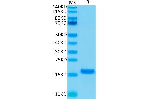 Human IL-21 on Tris-Bis PAGE under reduced condition. (IL-21 Protein)