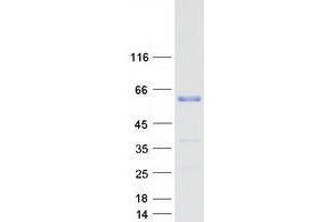 Validation with Western Blot (WTAP Protein (Transcript Variant 1) (Myc-DYKDDDDK Tag))