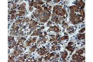 Immunohistochemical staining of paraffin-embedded pancreas tissue using anti-LIPG mouse monoclonal antibody. (LIPG antibody)