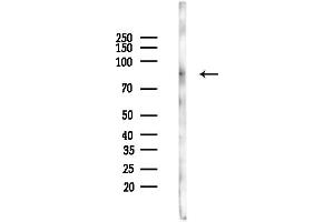 anti-Hydroxyacyl-Coenzyme A Dehydrogenase/3-Ketoacyl-Coenzyme A Thiolase/enoyl-Coenzyme A Hydratase (Trifunctional Protein), alpha Subunit (HADHA) (C-Term) antibody