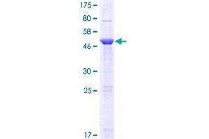 Image no. 1 for Family With Sequence Similarity 119A (FAM119A) (AA 1-218) protein (GST tag) (ABIN1310753) (FAM119A Protein (AA 1-218) (GST tag))