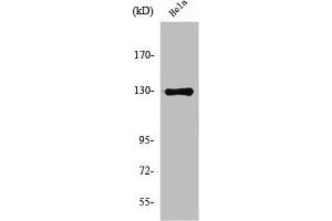 Western Blot analysis of HeLa cells using NOS2 Polyclonal Antibody (NOS2 antibody  (C-Term))