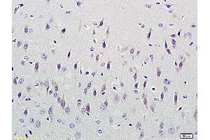 Formalin-fixed and paraffin embedded mouse kidney labeled with Anti-CUEDC2/CUE domain containing 2 Polyclonal Antibody, Unconjugated (ABIN707531) at 1:300 followed by conjugation to the secondary antibody and DAB staining