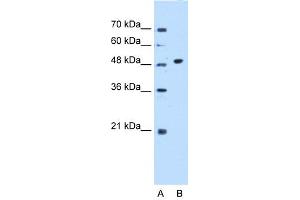 WB Suggested Anti-GTDC1 Antibody Titration:  0. (GTDC1 antibody  (N-Term))