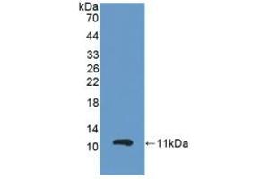 Detection of Recombinant GPX3, Mouse using Polyclonal Antibody to Glutathione Peroxidase 3, Plasma (GPX3) (GPX3 antibody  (AA 3-72))