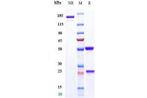 Anti-FOLR1 / FRA Reference Antibody (mirvetuximab) on SDS-PAGE under reducing (R) condition. (Recombinant FOLR1 (Mirvetuximab Biosimilar) antibody)