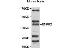 Western Blotting (WB) image for anti-Ectonucleotide Pyrophosphatase/phosphodiesterase 2 (ENPP2) (AA 564-863) antibody (ABIN3023334) (ENPP2 antibody  (AA 564-863))