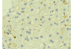ABIN6277274 at 1/100 staining Mouse liver tissue by IHC-P. (TGFBI antibody  (N-Term))