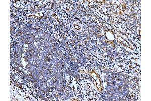 IHC analysis of Filamin B/FLNB using anti-Filamin B/FLNB antibody (ABIN7601606). (FLNB antibody  (AA 397-701))
