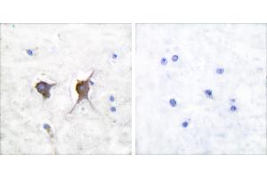 Peptide - +Immunohistochemical analysis of paraffin-embedded human brain tissue using Bax antibody (#C0132). (BAX antibody)