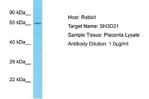 Host: Rabbit Target Name: SH3D21 Sample Tissue: Human Placenta Antibody Dilution: 1ug/ml (SH3D21 antibody  (C-Term))