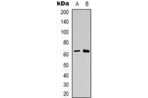 Western blot analysis of CSGALNACT2 expression in K562 (A), Jurkat (B) whole cell lysates. (CSGALNACT2 antibody)