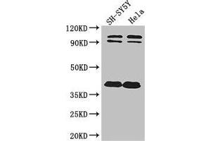 Western Blot Positive WB detected in: SH-SY5Y whole cell lysate, Hela whole cell lysate All lanes: DISC1 antibody at 2 μg/mL Secondary Goat polyclonal to rabbit IgG at 1/50000 dilution Predicted band size: 94, 92, 74, 39, 83, 63, 61, 76, 73, 38, 22 kDa Observed band size: 94, 92, 38 kDa (DISC1 antibody  (AA 99-325))