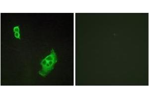 Immunofluorescence analysis of COS7 cells, using WAVE1 (Ab-125) Antibody. (WASF1 antibody  (AA 91-140))