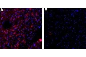 Expression of KCa2. (KCNN3 antibody  (Intracellular, N-Term) (Atto 594))