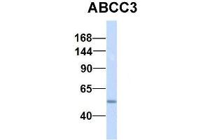 Host:  Rabbit  Target Name:  NSUN6  Sample Type:  Human Fetal Lung  Antibody Dilution:  1. (ABCC3 antibody  (Middle Region))