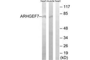 Western Blotting (WB) image for anti-rho Guanine Nucleotide Exchange Factor (GEF) 7 (ARHGEF7) (AA 311-360) antibody (ABIN2890591) (ARHGEF7 antibody  (AA 311-360))