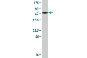 Western Blot detection against Immunogen (60. (MAGEA9 antibody  (AA 1-315))