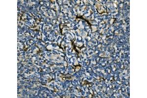 IHC analysis of EIF4A1 using anti-EIF4A1 antibody (ABIN7603125). (EIF4A1 antibody  (N-Term))