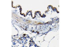 Immunohistochemistry (IHC) image for anti-Tumor Necrosis Factor Receptor Superfamily, Member 1A (TNFRSF1A) (AA 22-211) antibody (ABIN1513619)