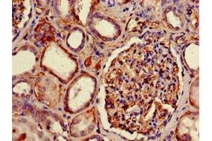 Immunohistochemistry (IHC) image for anti-Major Histocompatibility Complex, Class I, B (HLA-B) (AA 25-308) antibody (Biotin) (ABIN7155622)