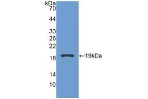 Grancalcin anticorps  (AA 1-139)