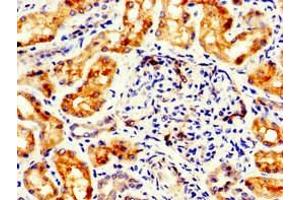 Immunohistochemistry of paraffin-embedded human kidney tissue using ABIN7153171 at dilution of 1:100 (FLI1 antibody  (AA 205-331))