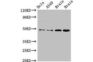 Western Blot Positive WB detected in: Hela whole cell lysate, A549 whole cell lysate, Rat brain tissue, Mouse brain tissue All lanes: GJA8 antibody at 2. (GJA8 antibody  (AA 286-432))
