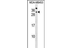 CEAC Antibody (Center) (ABIN1537760 and ABIN2848792) western blot analysis in MDA-M cell line lysates (35 μg/lane). (CEACAM7 antibody  (AA 112-140))