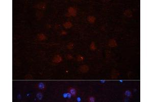 Immunofluorescence analysis of Rat brain using ASPN Polyclonal Antibody at dilution of 1:100 (40x lens). (Asporin antibody)