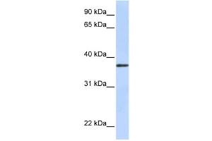 Western Blotting (WB) image for anti-Transmembrane Protein 200B (TMEM200B) antibody (ABIN2458847) (TMEM200B antibody)