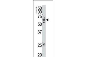 Antibody is used in Western blot to detect SENP2 in mouse heart tissue lysate. (SENP2 antibody  (C-Term))