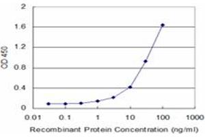 Detection limit for recombinant GST tagged CSTB is approximately 1ng/ml as a capture antibody. (CSTB antibody  (AA 1-98))