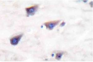 Image no. 2 for anti-Glutamate Receptor, Metabotropic 8 (GRM8) antibody (ABIN265441) (GRM8 antibody)