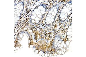 Immunohistochemistry of paraffin-embedded rat liver using Phospho--S473 Rabbit mAb (ABIN6135179, ABIN6135970, ABIN6135971 and ABIN7101880) at dilution of 1:100 (40x lens). (AKT1 antibody  (pSer473))