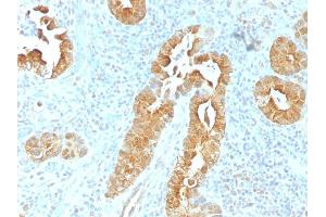 Formalin-fixed, paraffin-embedded human Rectum stained with Villin Mouse Monoclonal Antibody (VIL1/1325).